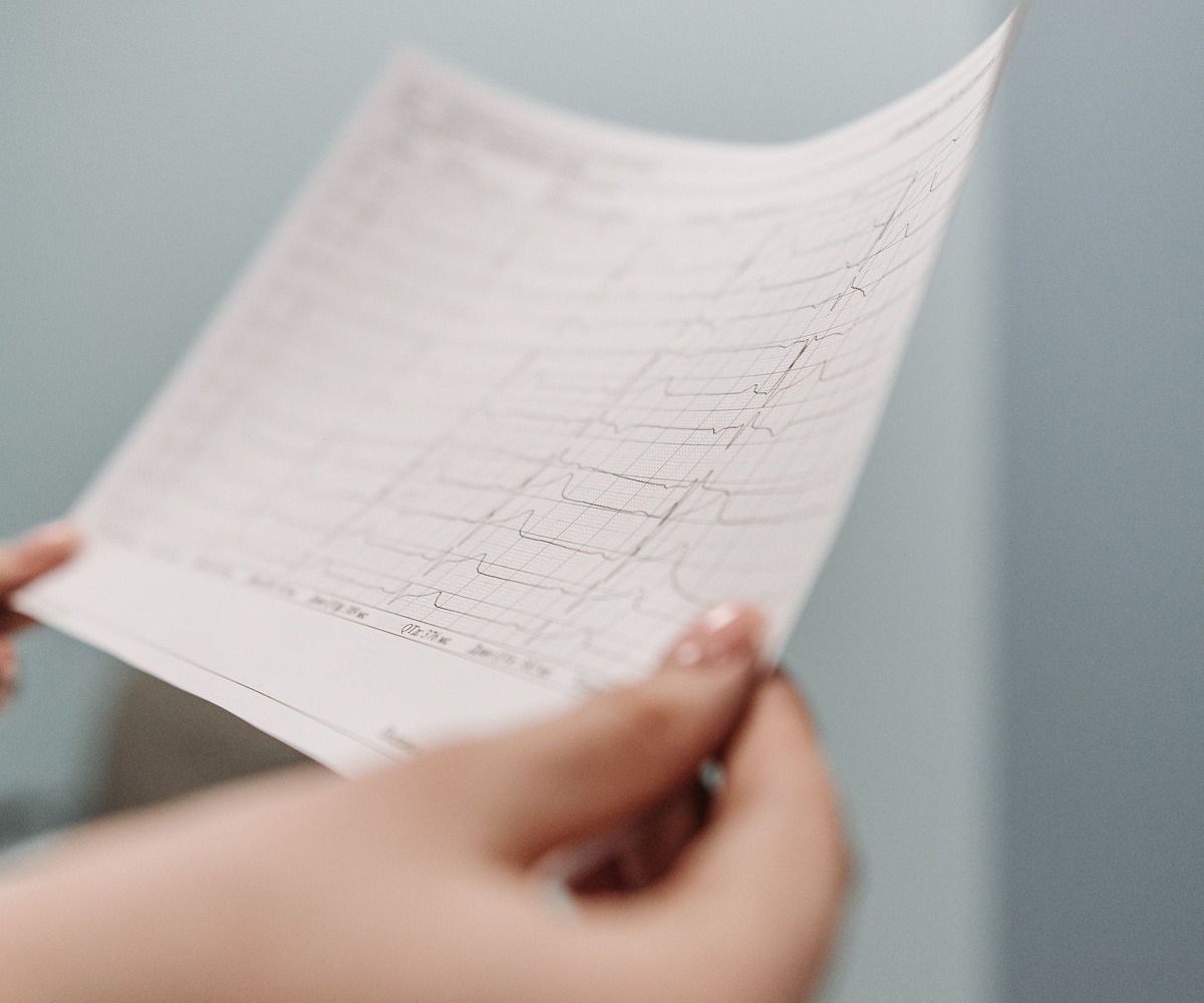 Imagine ilustrativă: electrocardiogramă (ecg)
